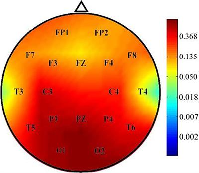 Increased Temporal Lobe Beta Activity in Boys With Attention-Deficit Hyperactivity Disorder by LORETA Analysis